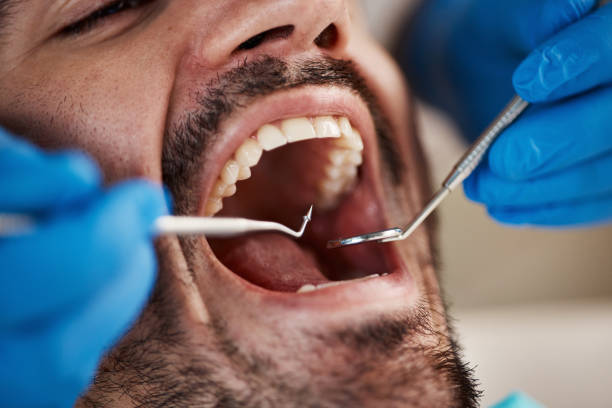 Best Tooth Pain Emergency Relief  in Crane, TX